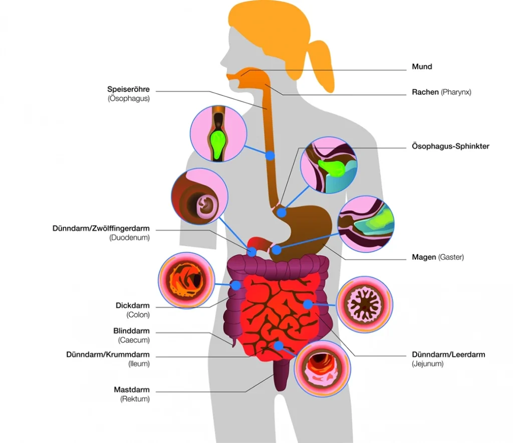 Schema des menschlichen Verdauungssystems mit beschrifteten Teilen in deutscher Sprache, einschließlich Mund, Rachen, Speiseröhre, Ösophagussphinkter, Magen, Zwölffingerdarm, Jejunum, Ileum, Blinddarm, Dickdarm und Mastdarm.